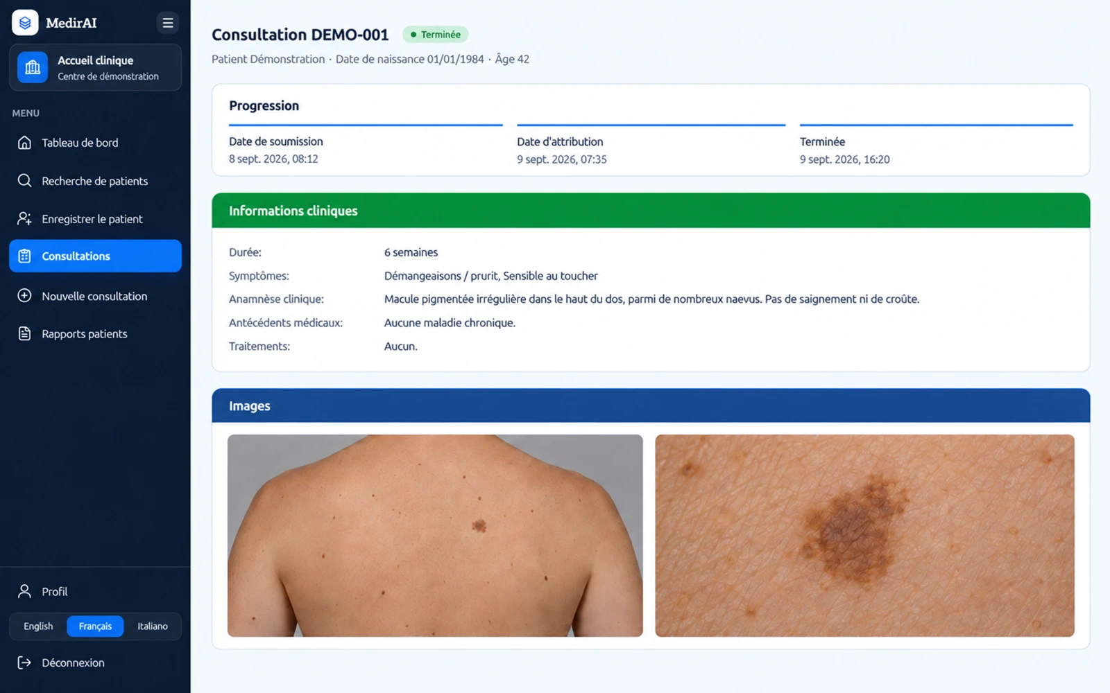 Illustration de Flow : l'en-tête du dossier d'une consultation terminée pour Patient Démonstration, avec le menu de navigation et le rôle Accueil clinique à gauche, les trois étapes datées (soumission, attribution, terminée) et les premiers champs d'informations cliniques.