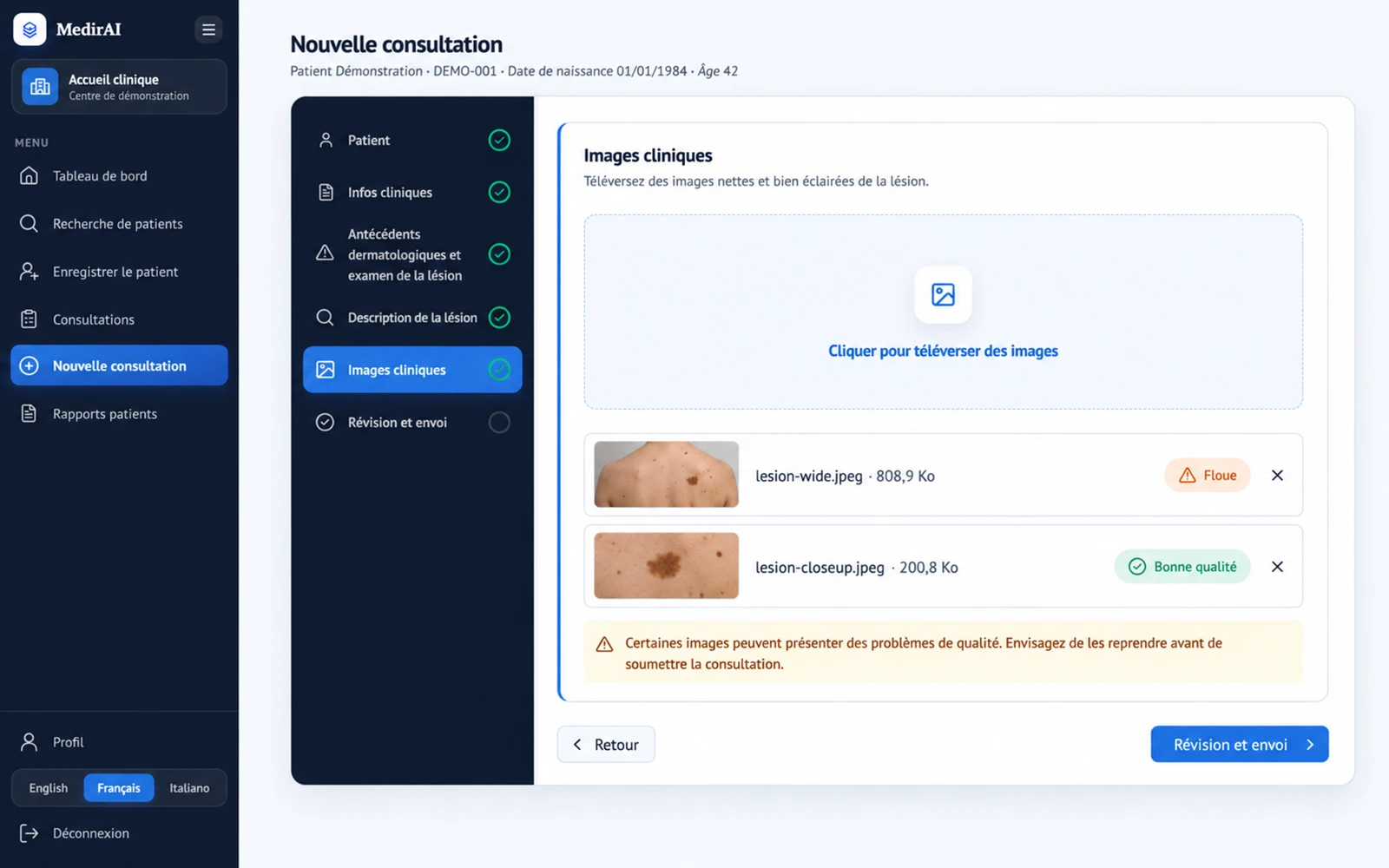 Illustration de Flow : l'étape Images cliniques de l'admission, où l'un des deux fichiers téléversés porte la mention Floue et l'autre Bonne qualité, au-dessus d'un avis invitant à reprendre les images avant de soumettre la consultation.